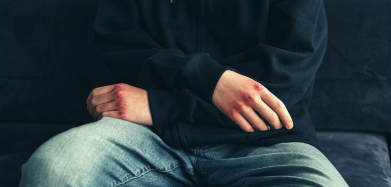 Got Injured On Your Job But Not Compensated Yet? Here’s What You Can Do Got Injured On Your Job But Not Compensated Yet